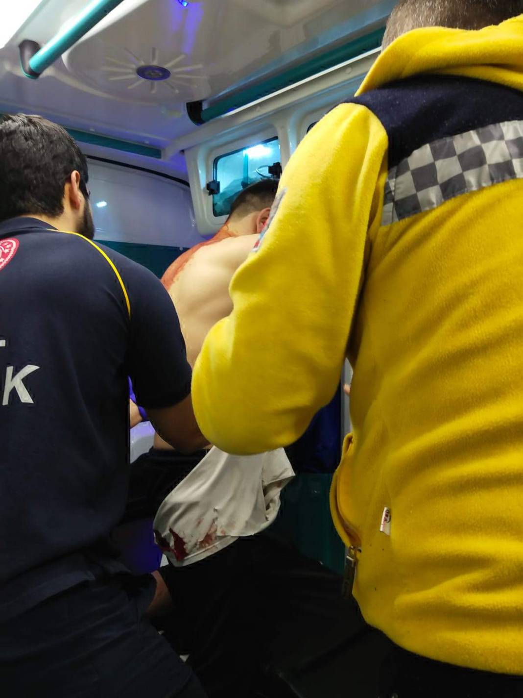 3 yıl önce zıpkınla yaralanmıştı, bu kez silahlı saldırıda öldü 7